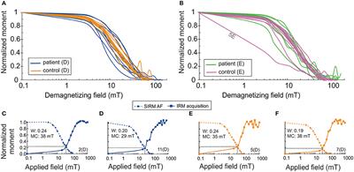 Magnetic Nanoparticles in Human Cervical Skin